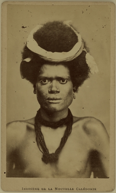 Portrait of a male native from New Caledonia - albumen carte de visite photograph by Allan Hughan (1834-1883)